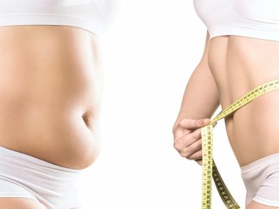 Body Contouring
